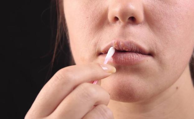 por que pleito el animal virus labial